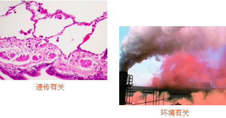 红胎记病因
