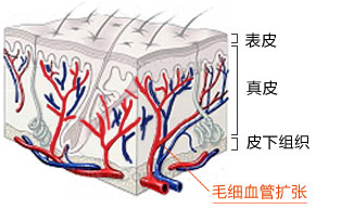 红胎记色素位置