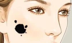 不会自己消失