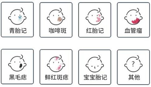 去除胎记